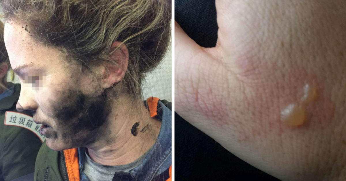Esplodono gli auricolari di una donna australiana durante il volo