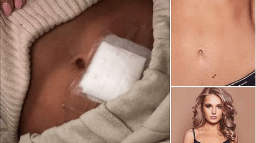 Le foto postate su Facebook dalla modella