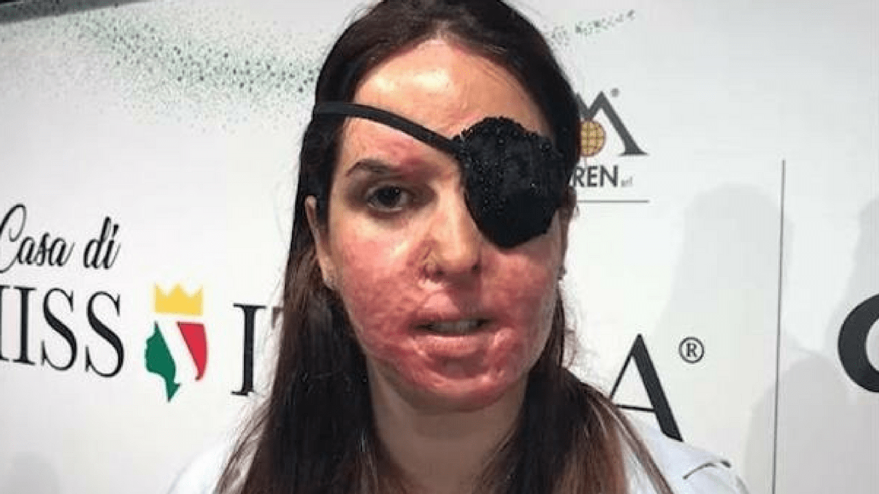 Ballando con le stelle 2018: in pista anche Gessica Notaro
