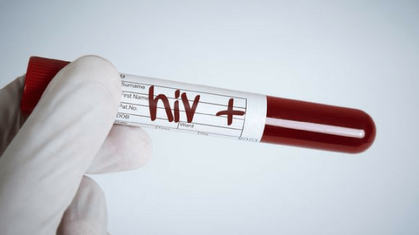HIV, provetta sangue, immagine di repertorio