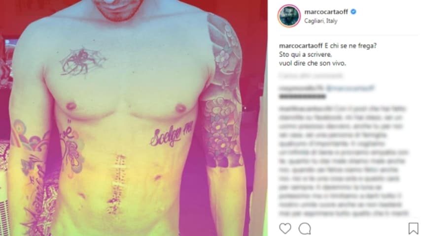 Marco Carta racconta l'operazione d'urgenza che ha dovuto subire
