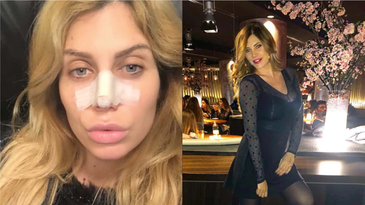 Paola Caruso operata d'urgenza al naso dopo un incidente in diretta