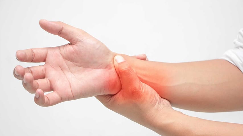 Artrite reumatoide