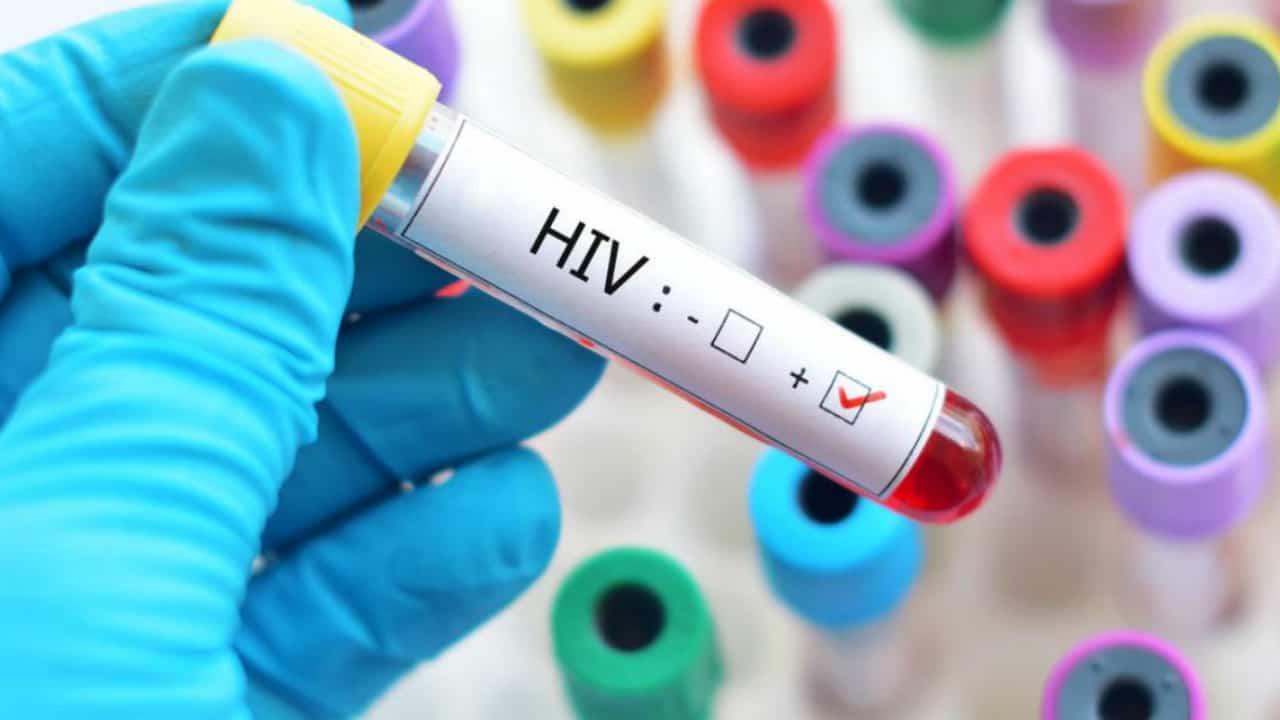 Si vendica dell'ex contagiandola con l'aids