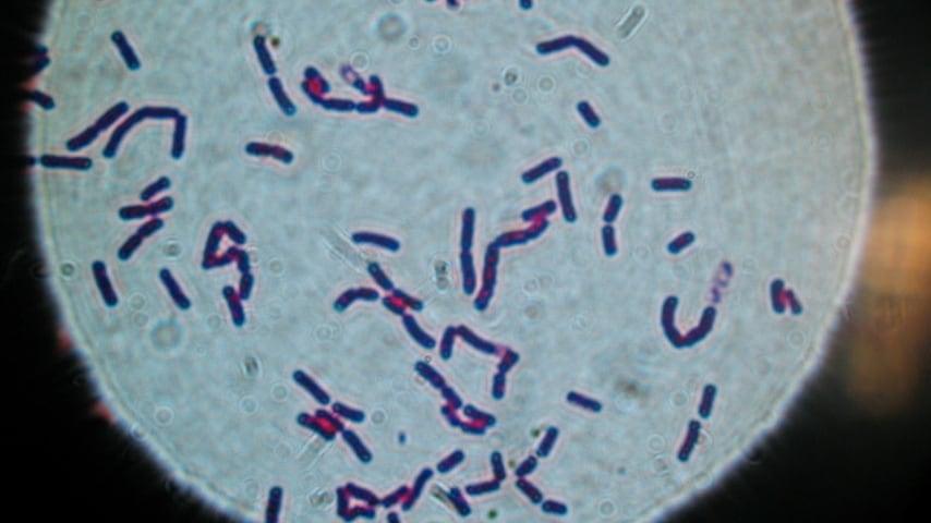 bacillus cereus