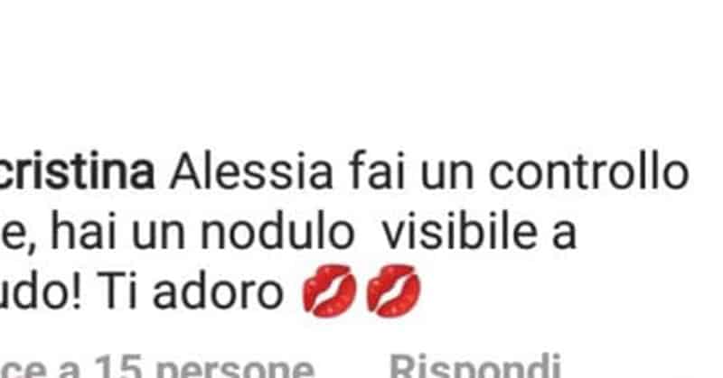 nodulo-alessia