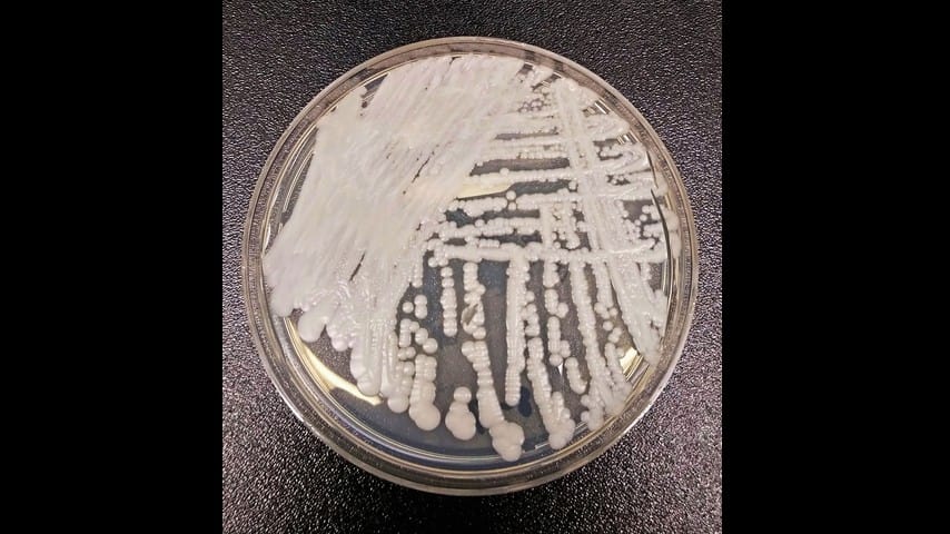 Candida auris