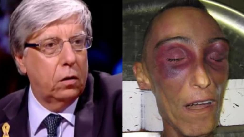 primo piano di carlo giovanardi e il volto tumefatto di stefano cucchi