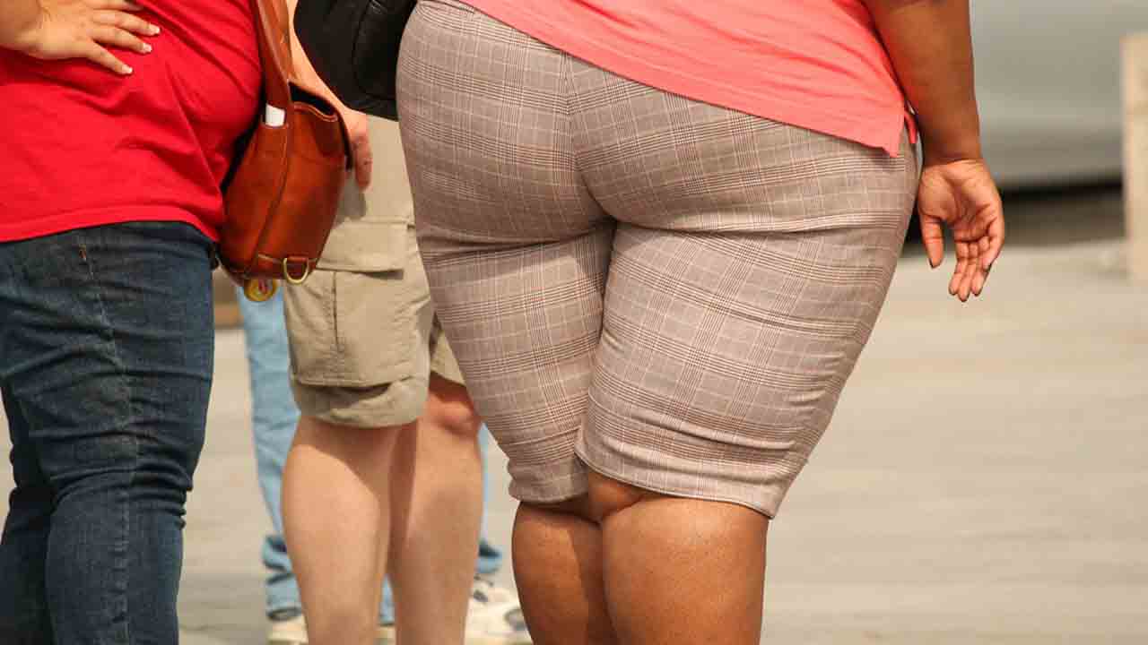 gambe di una donna che soffre di obesità