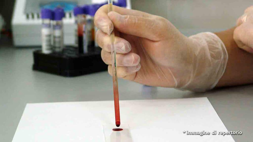 mano di un medico con provetta