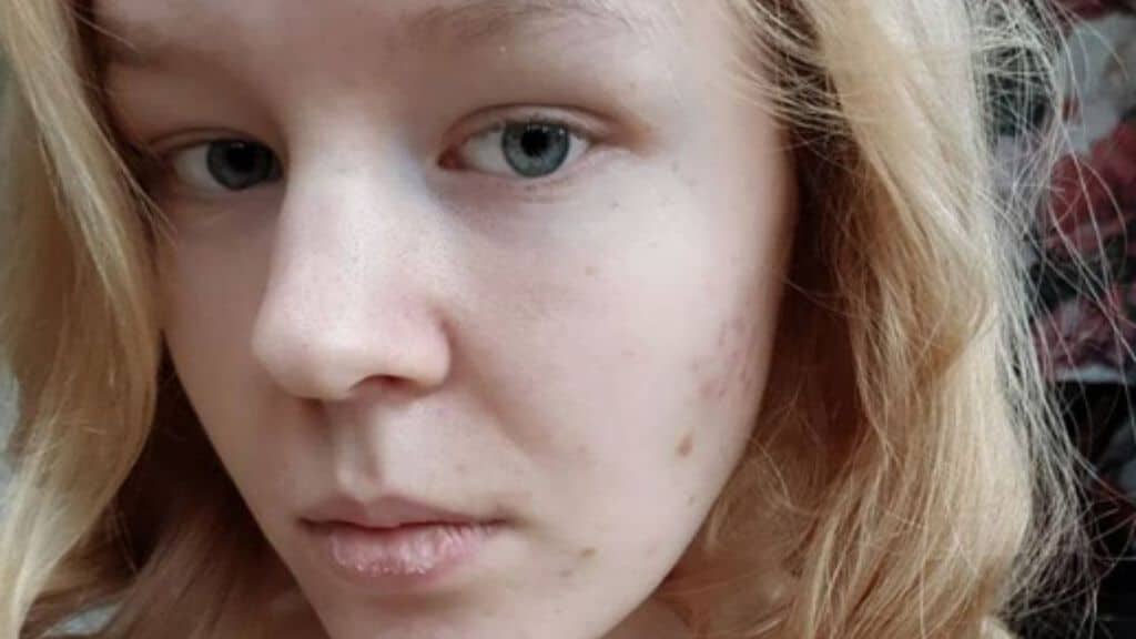 primo piano di noa pothoven