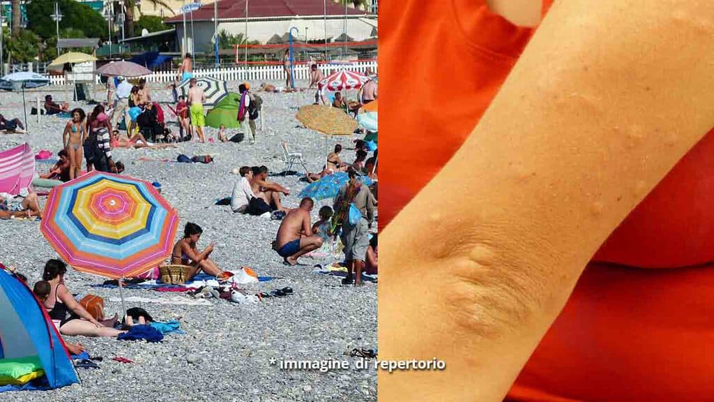 bagnanti in spiaggia e braccio con bolle