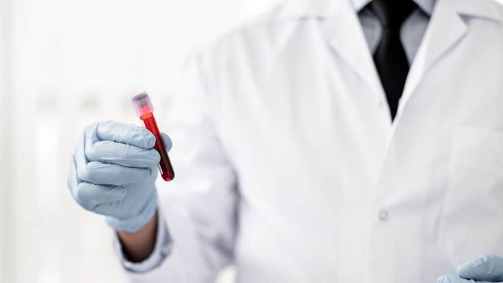 medico con provetta di sangue in mano