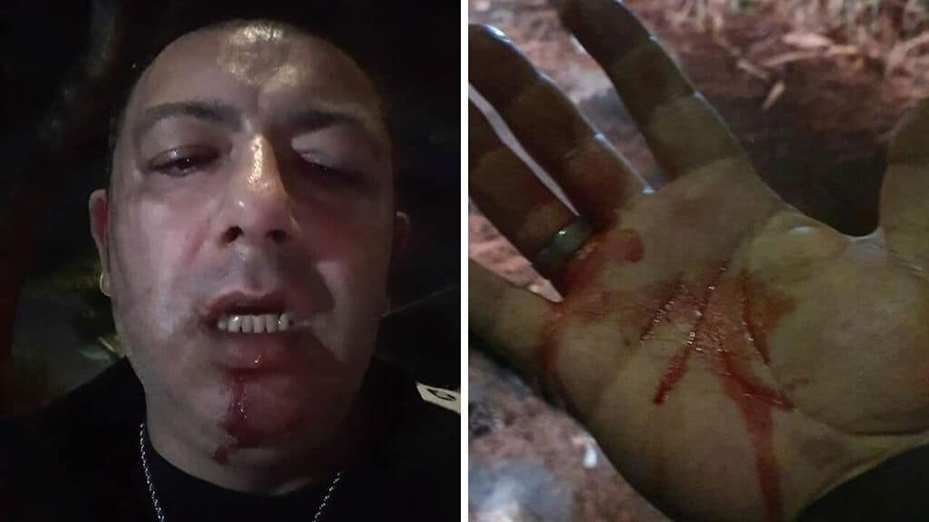 Il giornalista Pino Grazioli ha denunciato l'aggressione e le minacce di morte subite nella Terra dei Fuochi campana, dove bruciano illegalmente i rifiuti (Foto Facebook)