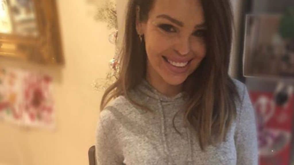 La modella Katie Piper