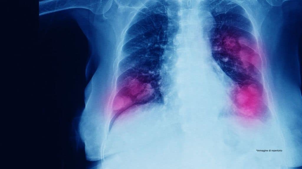 una radiografia