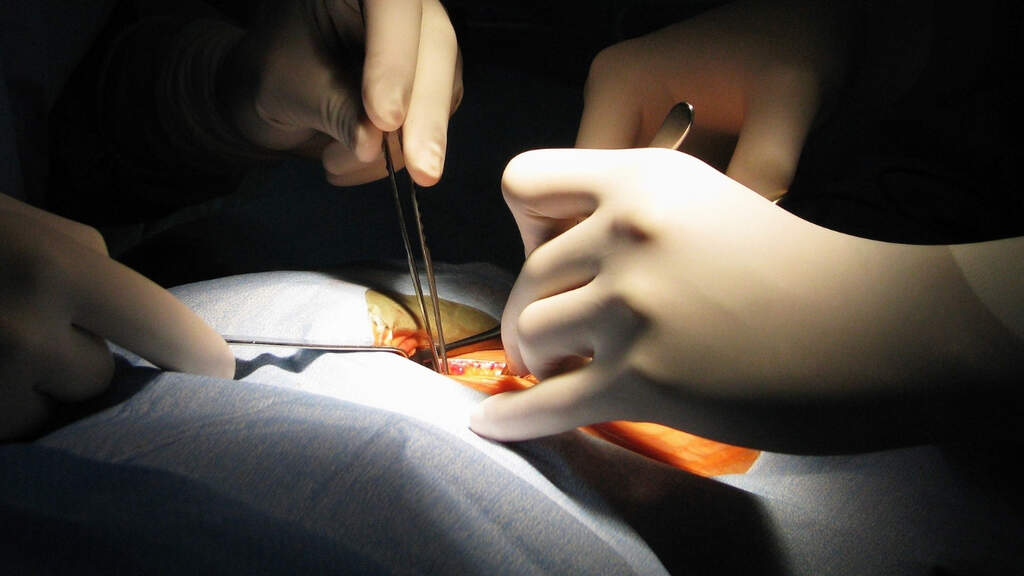 trapianto ospedale