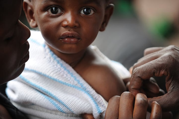 Bambino vaccinato in Congo