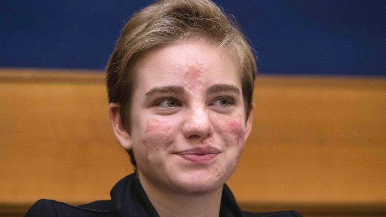 Bebe Vio Ora E Una Barbie Spero Di Essere Una Fonte D Ispirazione Bebe Vio Ora E Una Barbie Spero Di Essere Una Fonte D Ispirazione