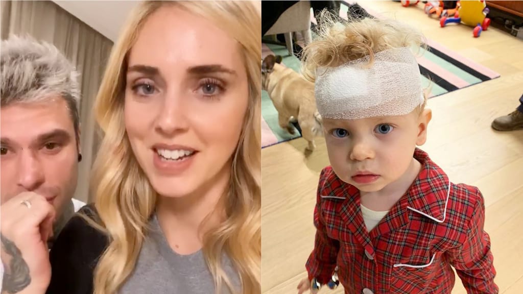 fedez, ferragni e leone, primo piano