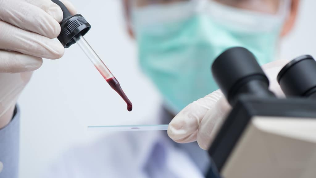 sangue infetto