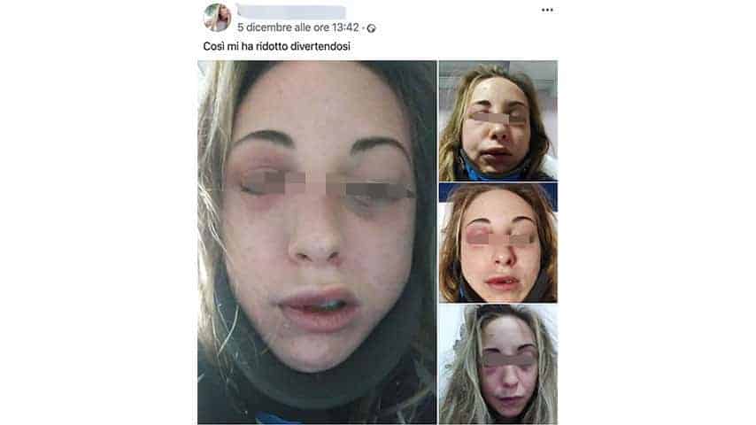Post di denuncia della ragazza picchiata