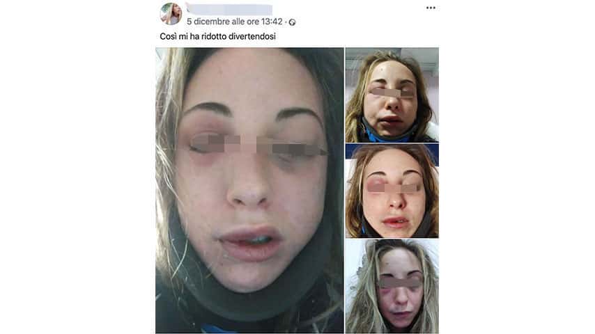 Post di denuncia della ragazza di Bastia Umbra su Facebook