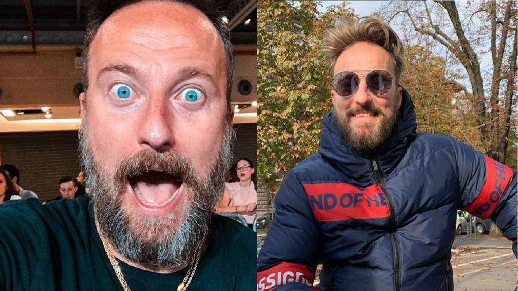 francesco facchinetti trapianto di capelli non chirurgico