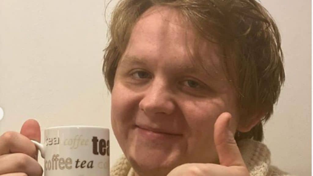 lewis capaldi in primissimo piano