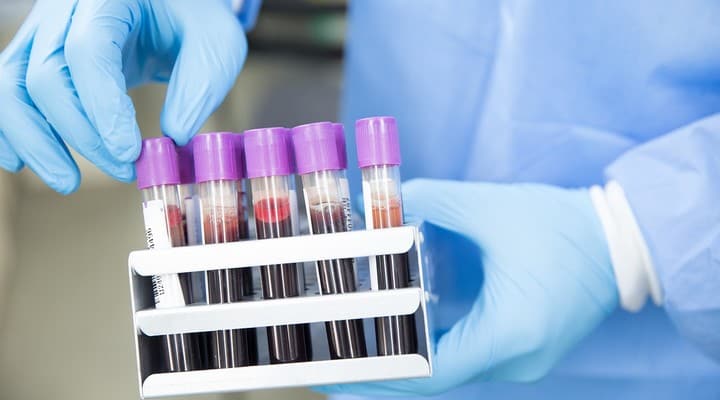 test, esami del sangue