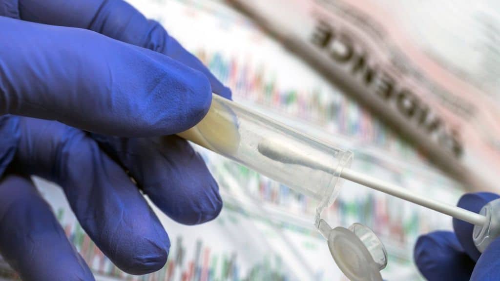 provetta per il test sierologico