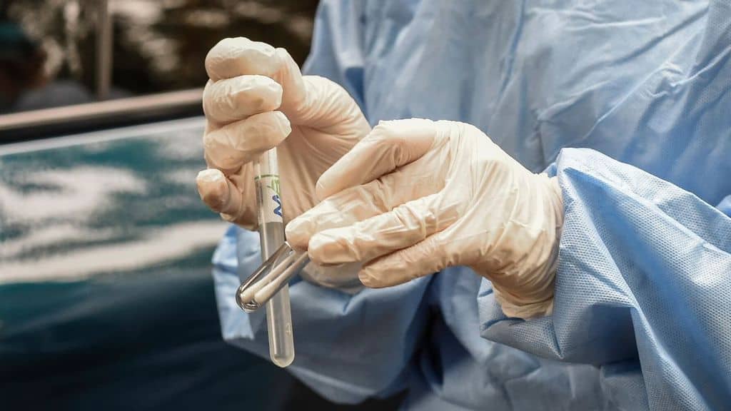 mani di una dottoressa che tiene delle provette