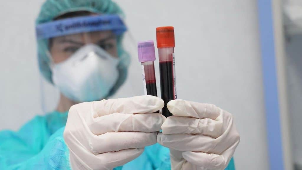 Fiale di sangue per il test sul Coronavirus