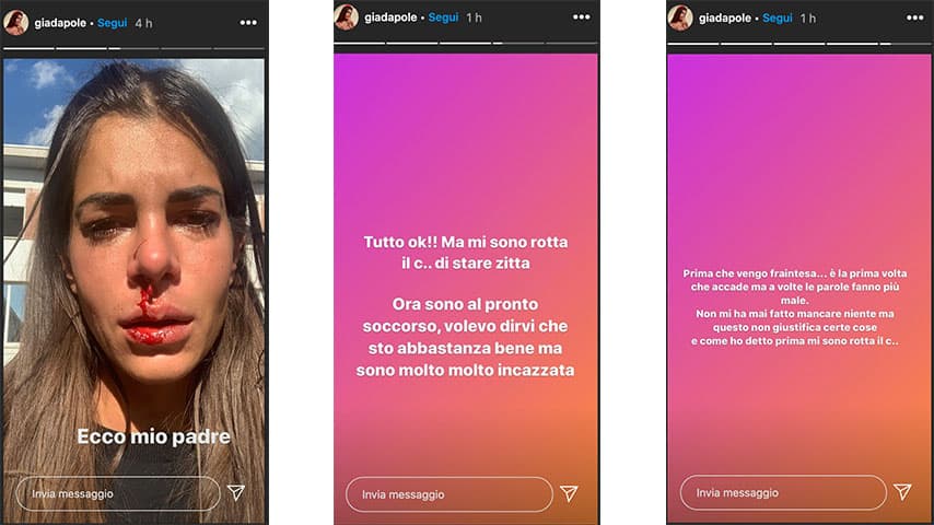 Instagram Stories di Giada Giovanelli