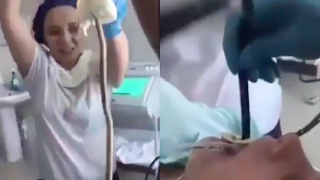Medici estraggono serpente di oltre un metro dalla bocca di una donna – FOTO Medici estraggono serpente di oltre un metro dalla bocca di una donna – FOTO