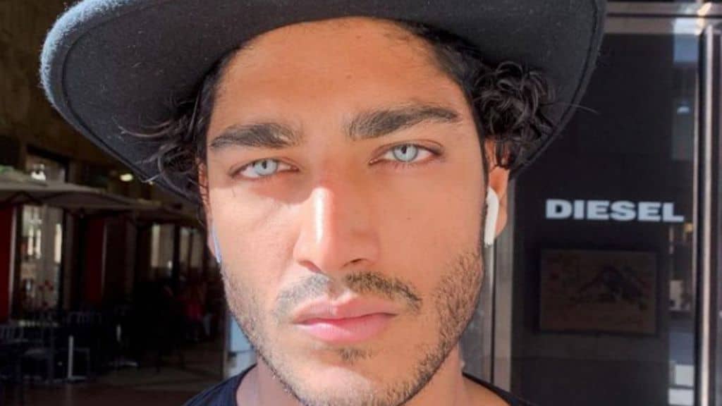 Akash Kumar, dopo il mistero sul nome i dubbi sul colore dei suoi occhi azzurro ghiaccio: il sospetto del "ritocchino" estetico