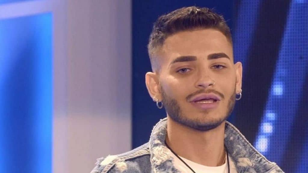 cristian imparato rifatto liposuzione