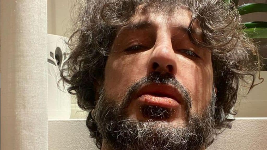 fabrizio corona ricoverato in psichiatria si fa del male