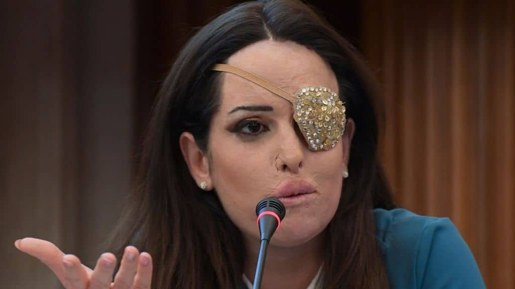 Gessica Notaro, nessuna attenuante per Edson Tavares che la sfregiò con l’acido: il motivazioni di sentenza della Cassazione