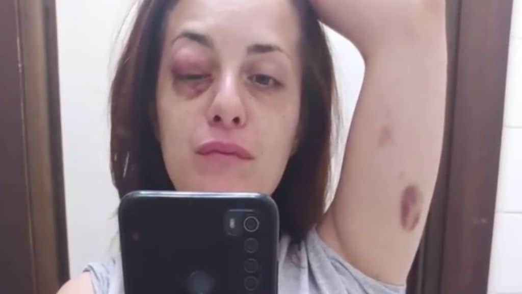 Giuliana Danzè denuncia le violenze subite