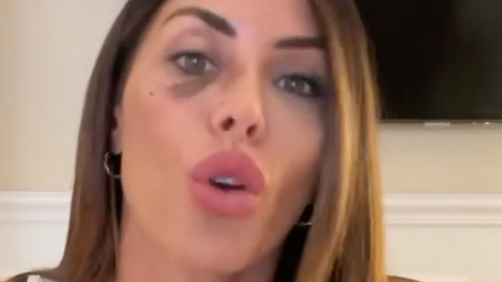 Guendalina Tavassi su Instagram parla dell'aggressione