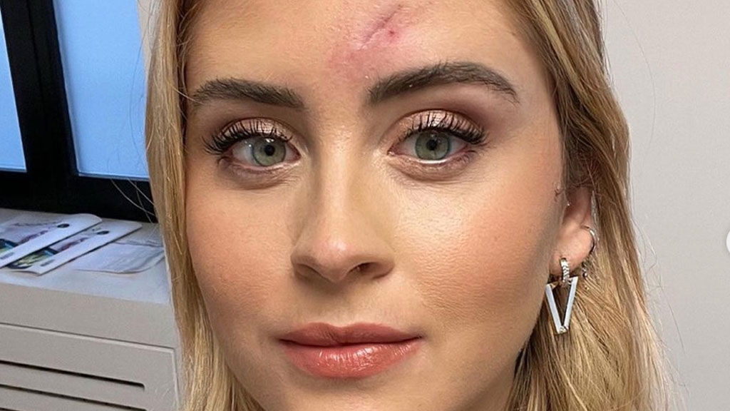 Valentina Ferragni e il tumore