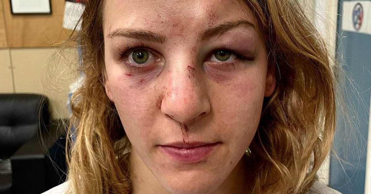 Margaux Pinot denuncia violenze del compagno