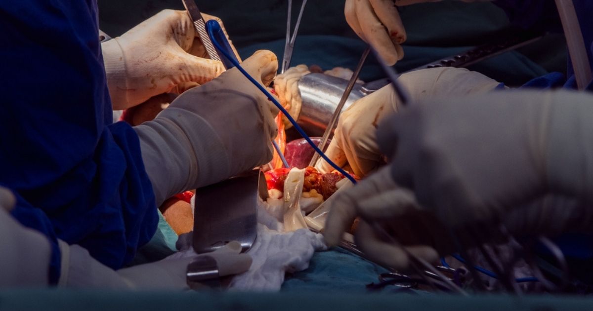 Trapianto di rene, le famiglie di due donne israeliane e una araba si scambiano gli organi per farle vivere
