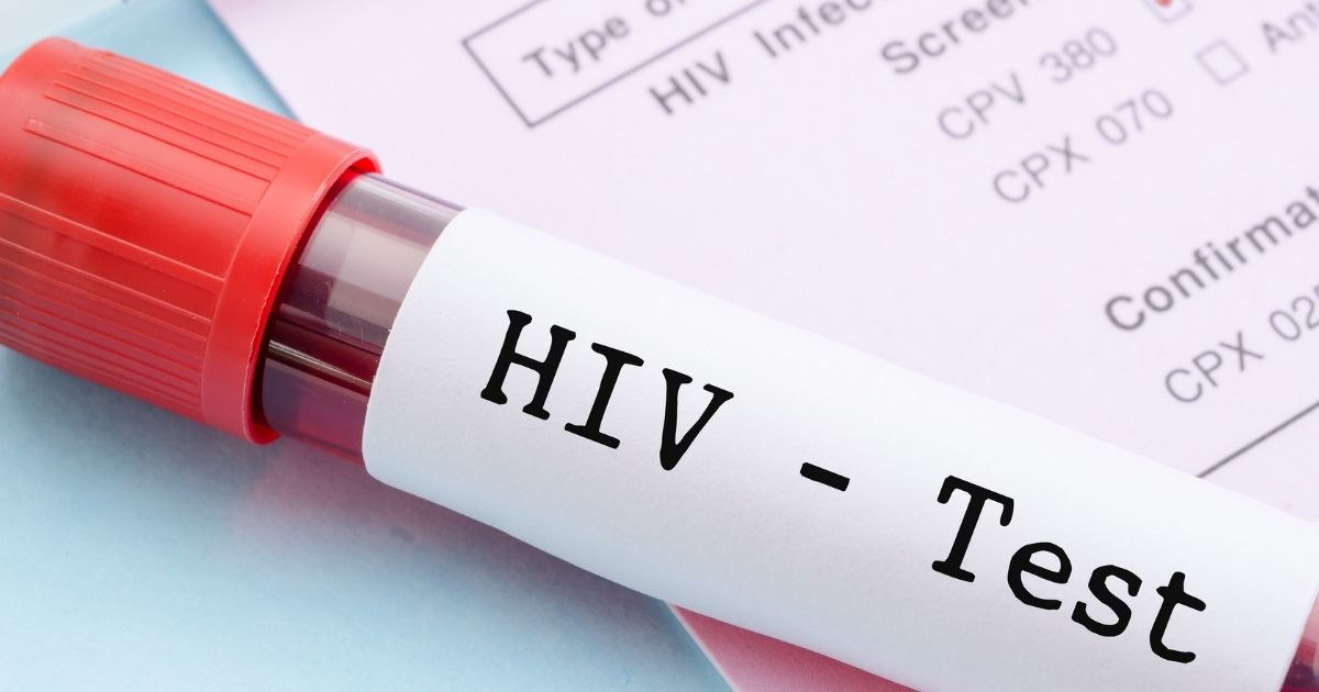 Aids, contagia la compagna lasciandola all'oscuro di tutto. Lei è morta dopo 2 anni di agonia: condannato