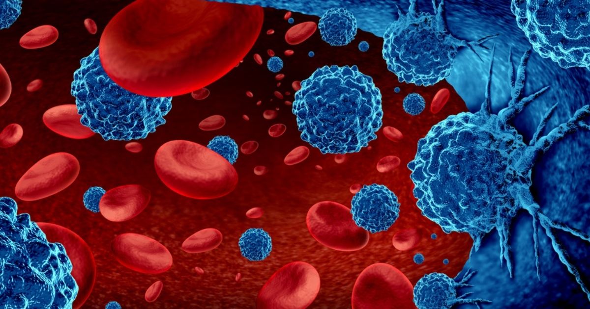 Mieloma Multiplo, arriva l'Isatuximab, il farmaco che può cambiare la vita dei pazienti
