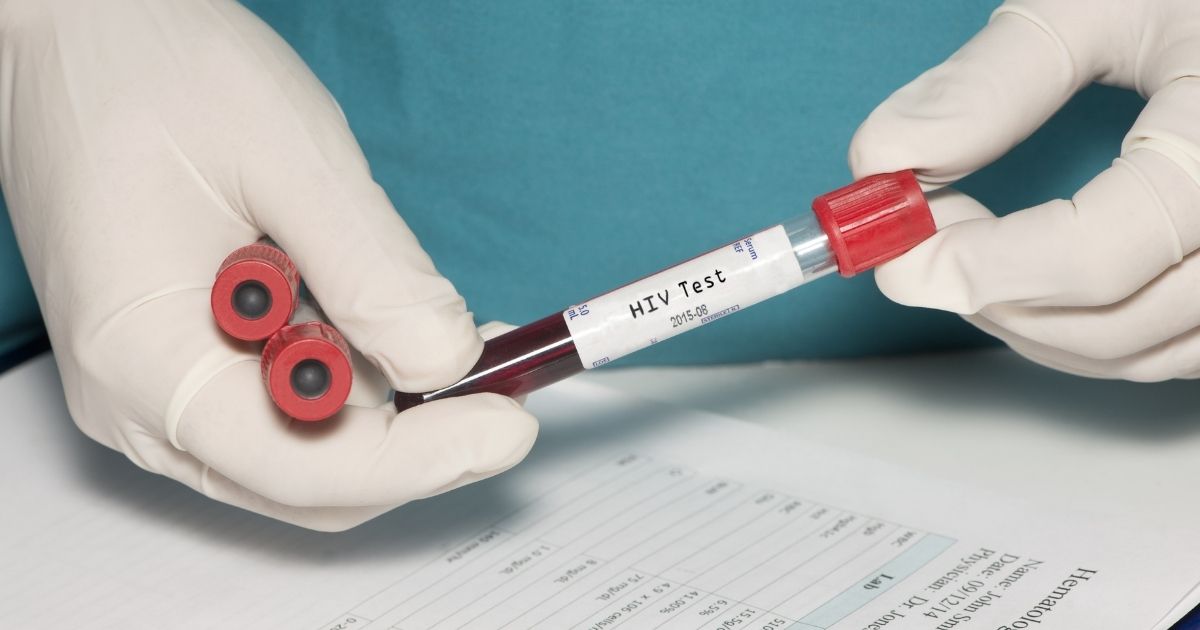 Donna guarisce dall'HIV: è il primo caso al mondo con trapianto di cellule staminali dal cordone ombelicale