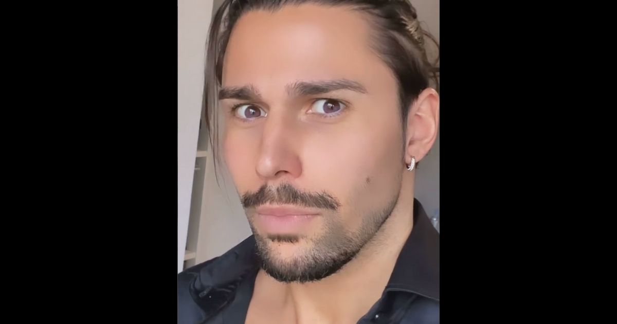 Luca Onestini si presenta ai fan con un occhio nero e parla di "triste storia": poi spiega cosa gli è successo