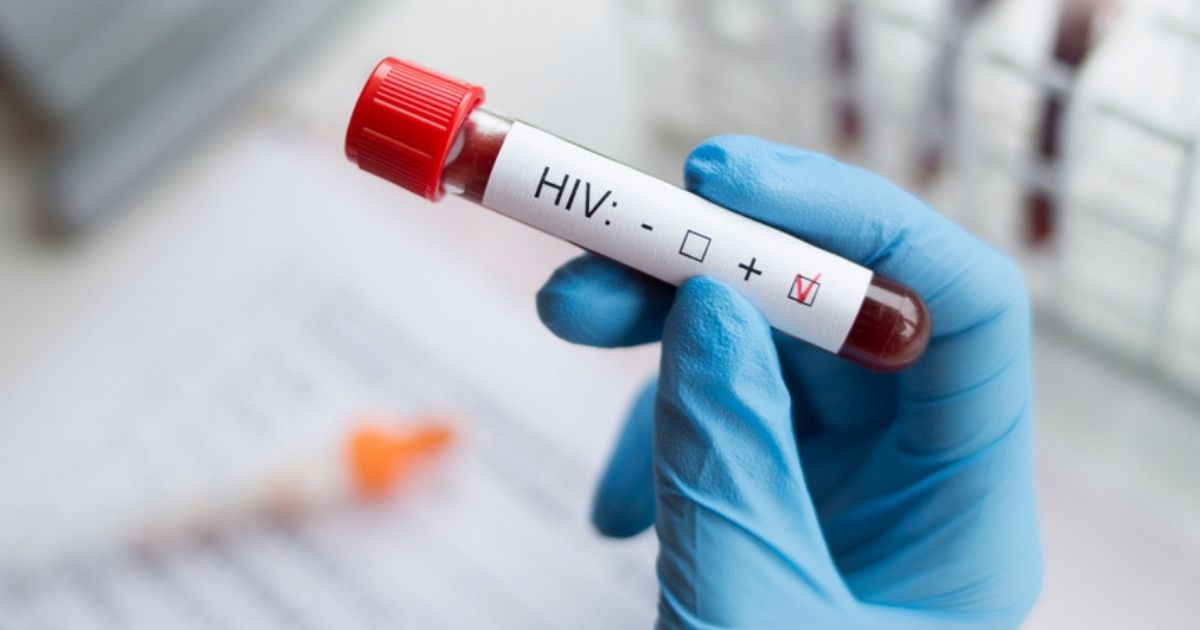 Vaccino contro l’Aids: al via la sperimentazione e lo studio clinico, somministrata la prima dose
