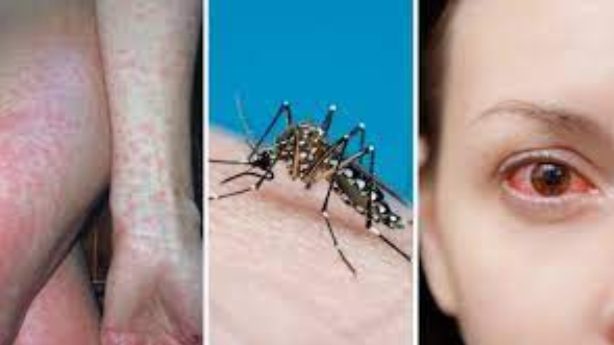 Italia, allarme febbre Dengue, 4 giorni di chiusura delle scuole